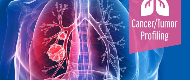 Cancer/Tumor Profiling Market