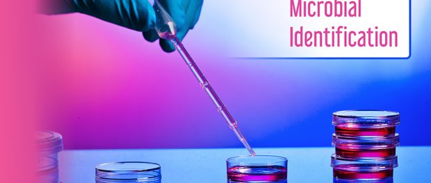 Microbial Identification Market