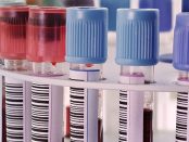 Clinical Laboratory Services Market