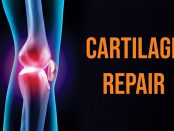 Cartilage Repair Market
