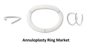 Annuloplasty Ring Market