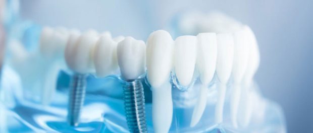 Dental Biomaterials Market