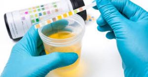 Drug Abuse Testing Market