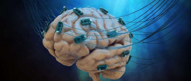 Neuroprosthetics Market