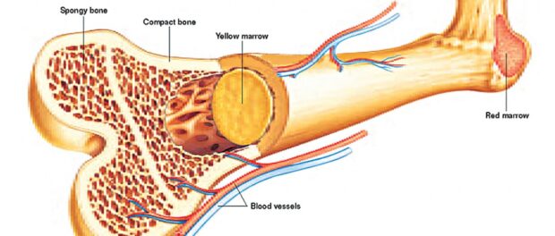 Bone Marrow Transplant Cost