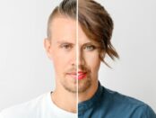 transgender hair transplant- Beverly Hills Hair Restoration Offers MTF and FTM hair transplant with their Advanced Hair Restoration Techniques