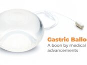 Gastric Balloons A boon by medical advancements