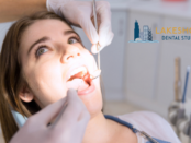 Wisdom Tooth Extraction Chicago
