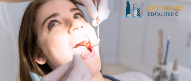 Wisdom Tooth Extraction Chicago