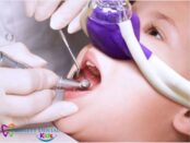 Sedation Dentistry Rowlett