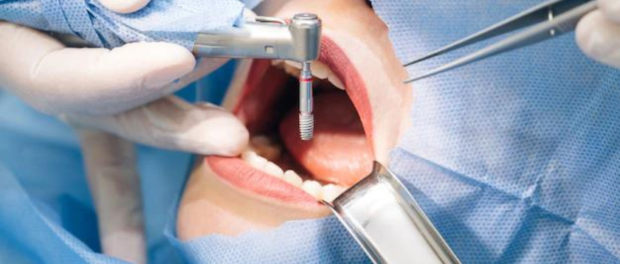 Implant Dentistry Whitehouse