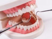 Dental Implants Magnolia