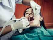 Root Canal Therapy Beverly Hills