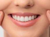 Cosmetic dentist Calistoga