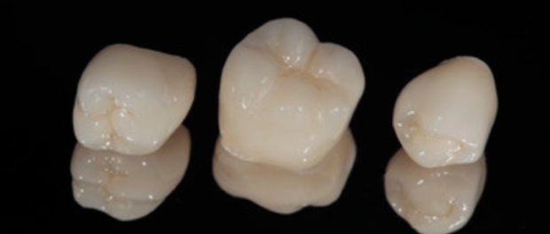 Dental-Crowns