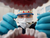 Dental Crown Palatine