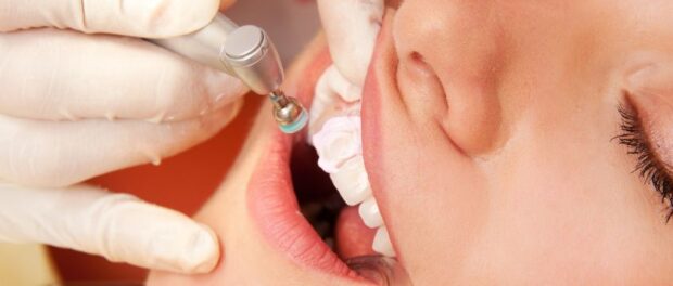 A lady patient undergoing Dental Bonding procedure