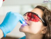 Teeth Whitening Artesia