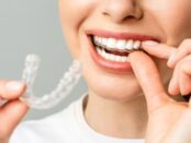 Invisalign in Stillwater