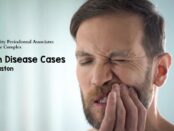 Gum disease cases in Houston, TX