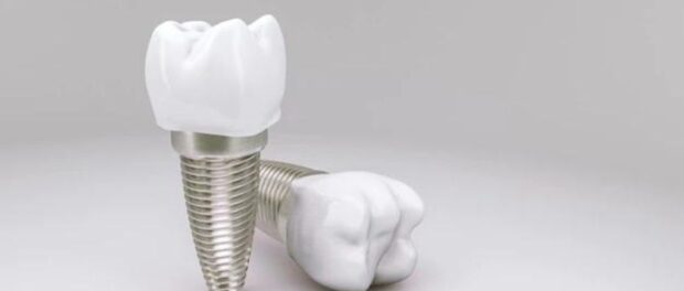 Dental Implant in Northglenn