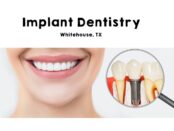 Dental Implant in Whitehouse