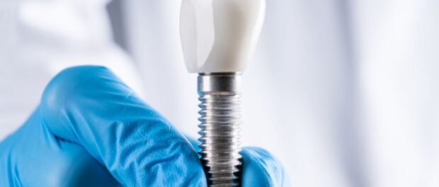 free dental implant consultation in broken arrow