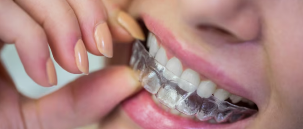 Invisalign in Dallas