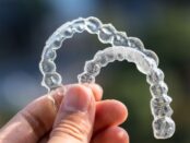 One-Stop Destination for Invisalign in West Palm Beach