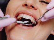Cosmetic dentist whitehouse
