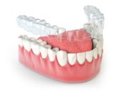 Invisalign Treatment In Fargo