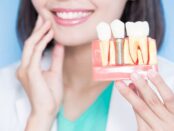 Dental Implants Redefined: Periodontal Specialists at the Forefront