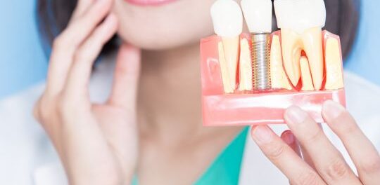 Dental Implants Redefined: Periodontal Specialists at the Forefront