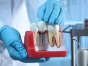 dental implant procedures