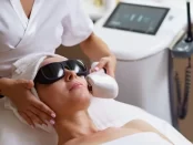 laser hair removal Edgware