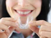 bruxism nightguard in boynton beach