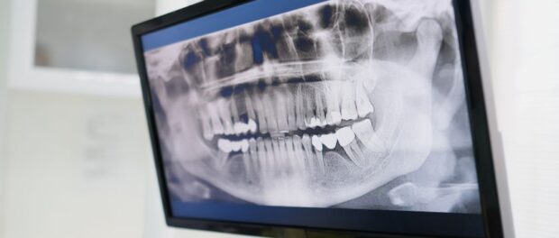 Hi-Tech Dentistry Comes to Evergreen: Explore the Future of Dental Care