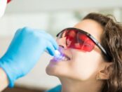 Teeth Whitening Artesia