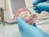 Dental Braces in Lenexa