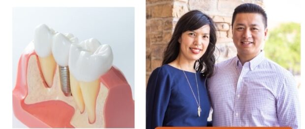 dental implants restoration in Denton TX