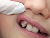 Pediatric Dental Health - Las Vegas Dentist - Aloha Dental Las Vegas