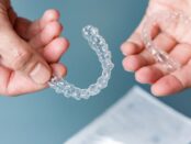 Invisalign in Layton