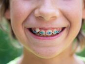 orthodontic treatment for kids in rowlett