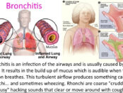 Bronchitis Treatment Market