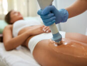Global Cellulite Treatment Industry