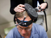 Deep Brain Stimulation Devices