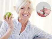 Dental Implants Solutions in Chandler