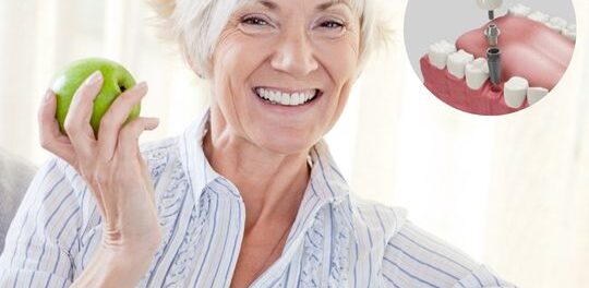 Dental Implants Solutions in Chandler