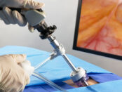 Endoscopy Devices