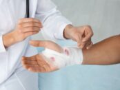 Global Chronic Wound Care Industry